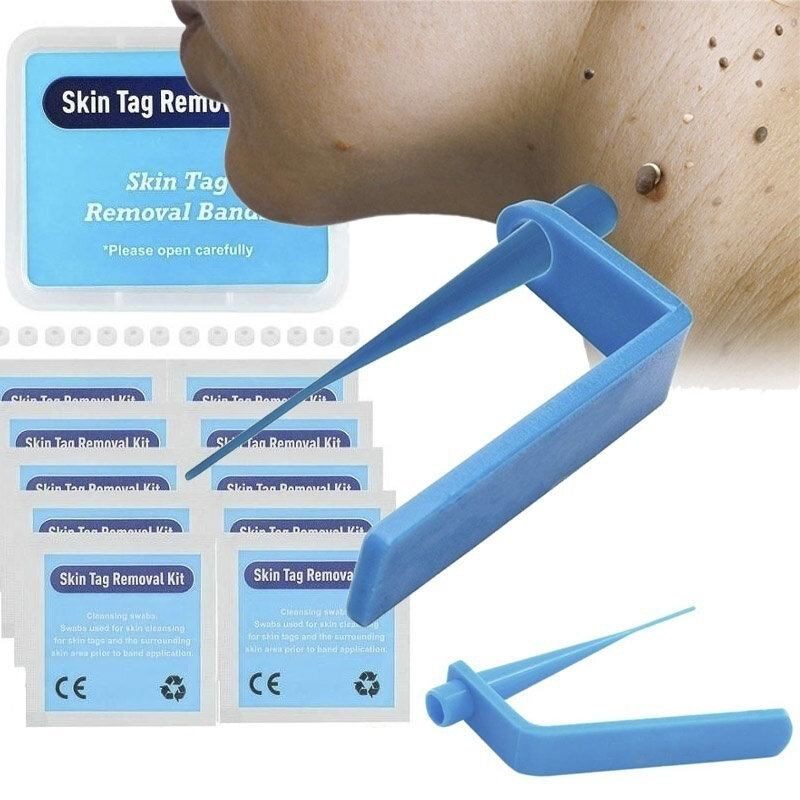 Home Micro Skin Tag Remover Set Medium Body Mole Wart Tag Removal Band